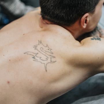 Laseri valgendamise protseduuri demonstreerimine