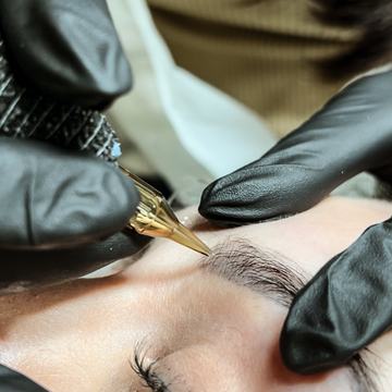 Tattoo remover technique training